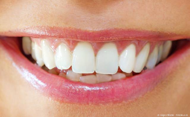 Zahnästhetik Schöne Zähne mit Veneers und mehr