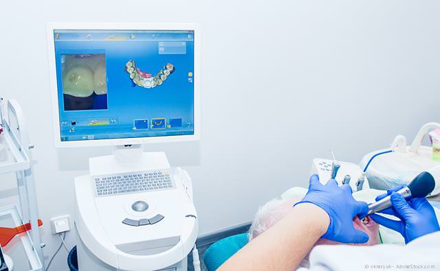 Cerec Koblenz: Zahnbehandlung mit Keramik innerhalb eines Tages